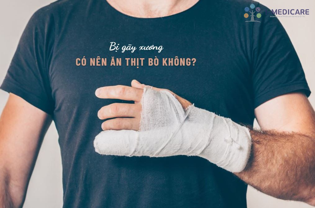 Bị gãy xương có nên ăn thịt bò không? Dinh dưỡng phục hồi xương