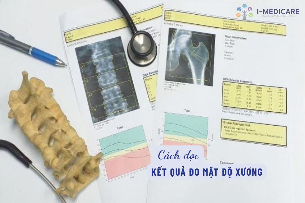 Cách đọc kết quả đo mật độ xương và phân tích T-score, Z-score