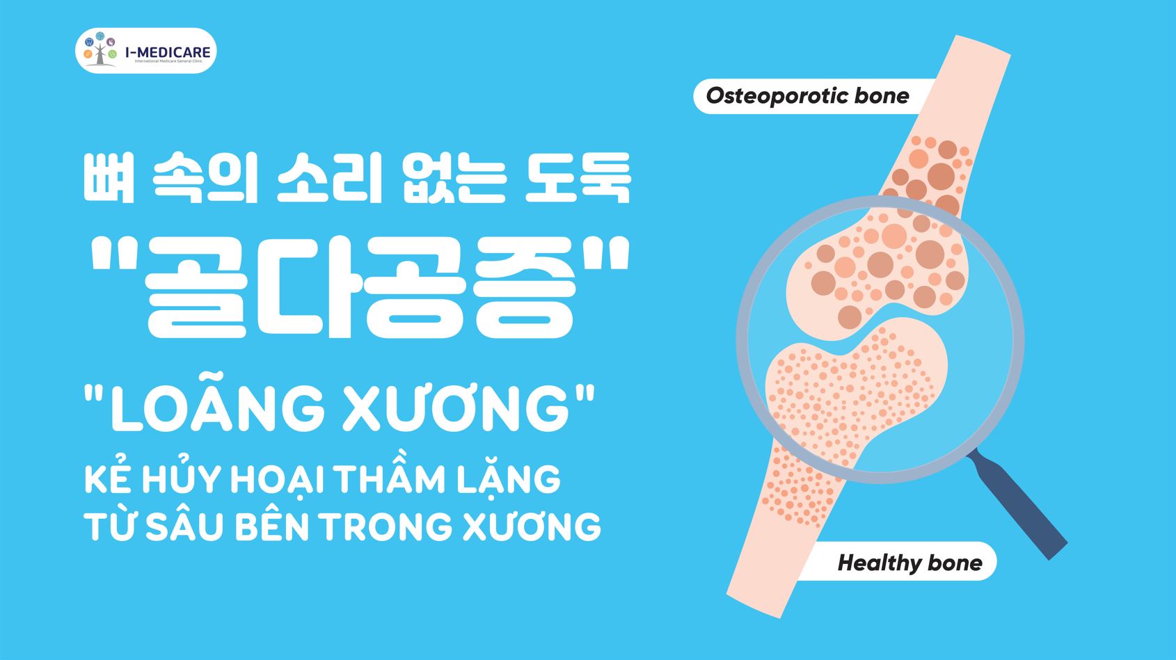 Đo Mật Độ Xương - Phát Hiện Sớm Nguy Cơ Loãng Xương Chính Xác Với AI