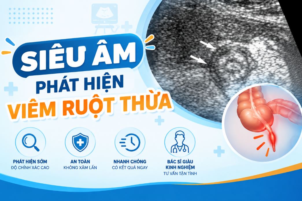 Siêu âm phát hiện viêm ruột thừa được không? Dấu hiệu và độ chính xác