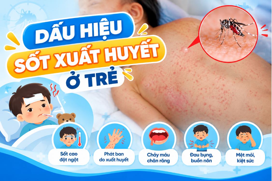 Dấu hiệu sốt xuất huyết ở trẻ: cách nhận biết từng giai đoạn và khi nào cần đi viện