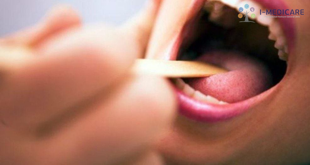 Ung thư miệng có thể phòng ngừa được không?