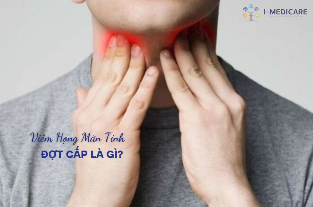 Viêm họng mãn tính đợt cấp là gì? Nhận biết để tránh biến chứng