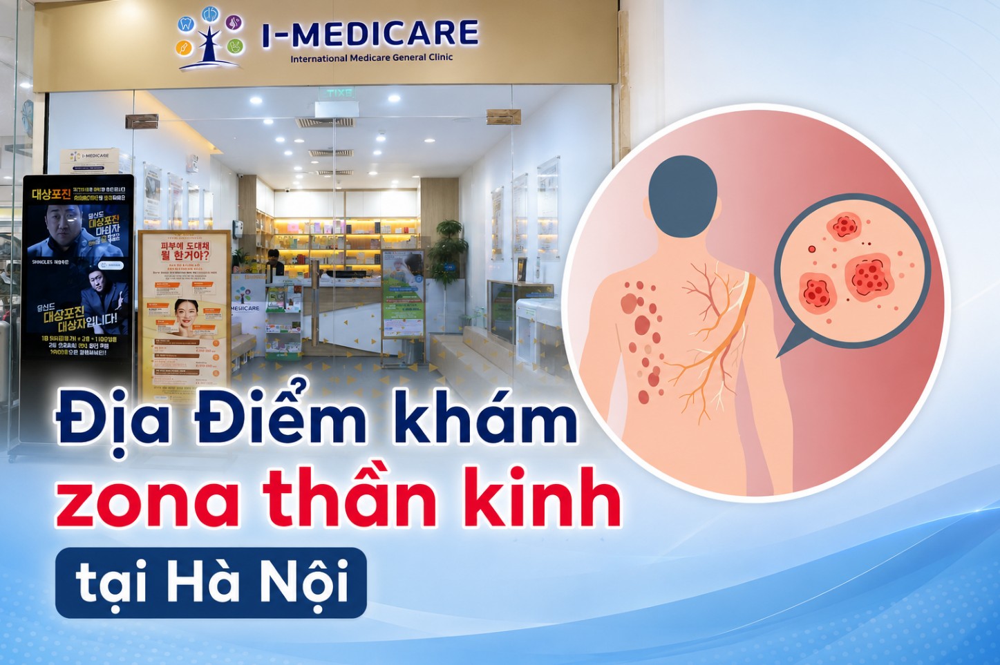 Địa chỉ khám zona thần kinh ở Hà Nội uy tín: Phòng Khám I-Medicare